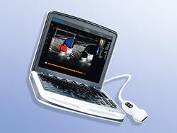Chison SonoBook™ 8 package AI-1