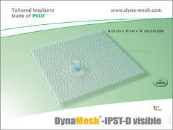 DynaMesh®-IPST visible, Dom 4 cm, dezentral rechts